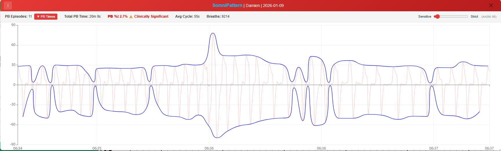 [OC] Hidden breathing patterns revealed through amplitude analysis of sleep data Analysis
