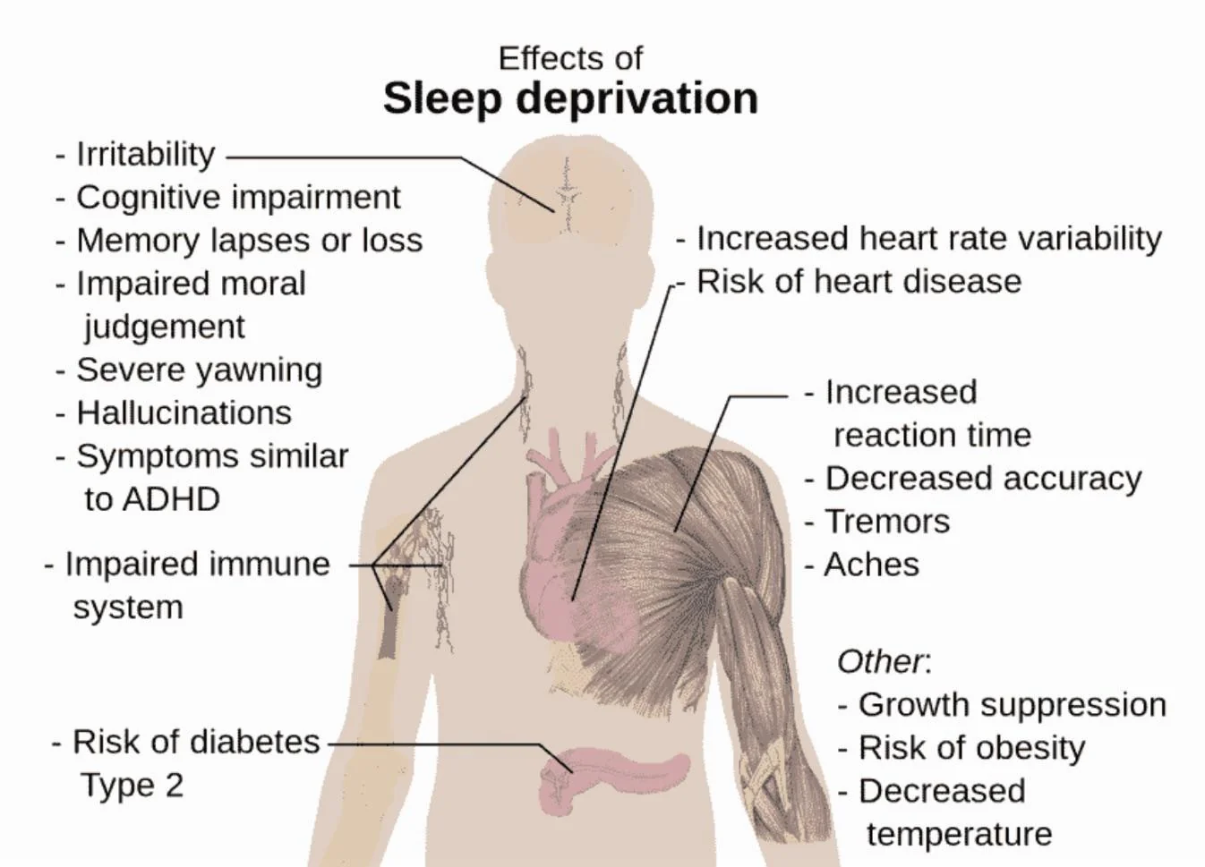 Sleep Deprivation Visualized Visualization